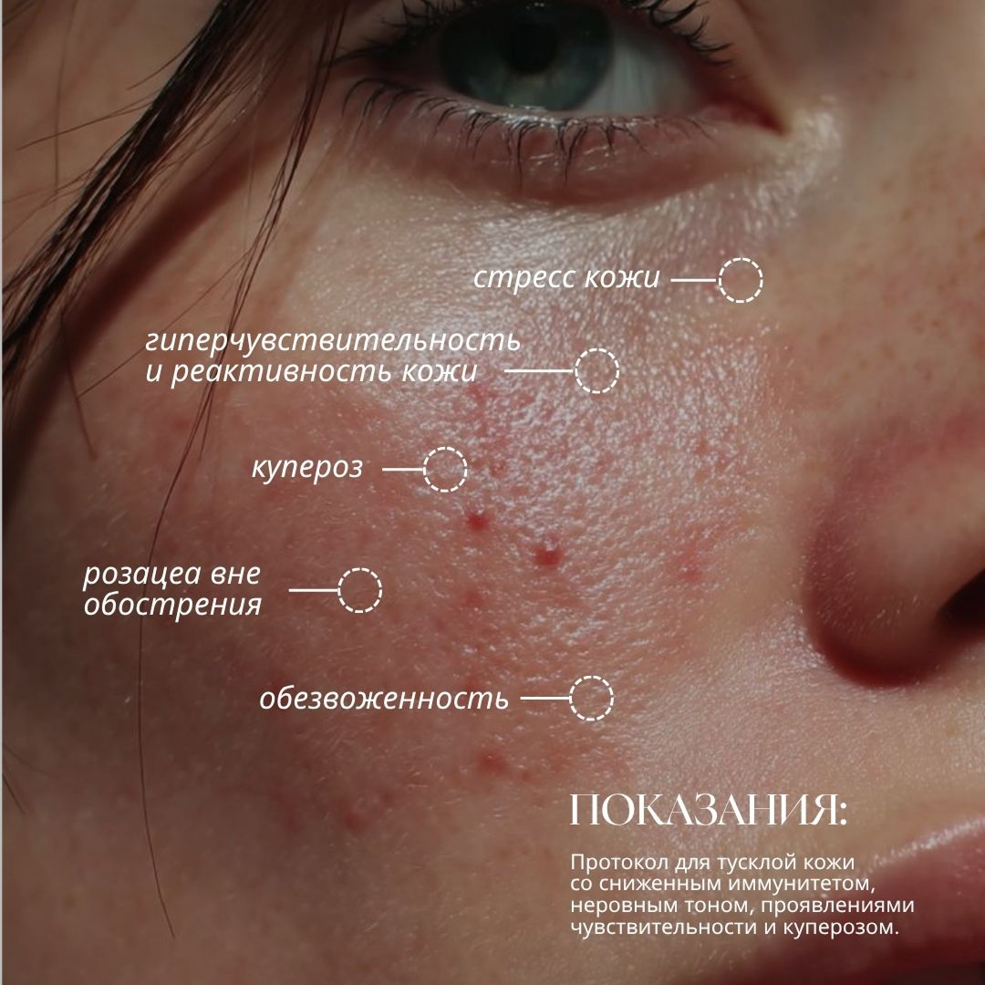 Процедура окситерапии